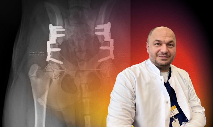 ORTHOSCHOOL. Лечение дисплазии тазобедренных суставов методом DPO (Двойная остеотомия таза)